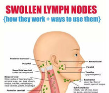 Load image into Gallery viewer, NATURALTHERAPY™ LYMPHATIC DRAINAGE GINGER OIL